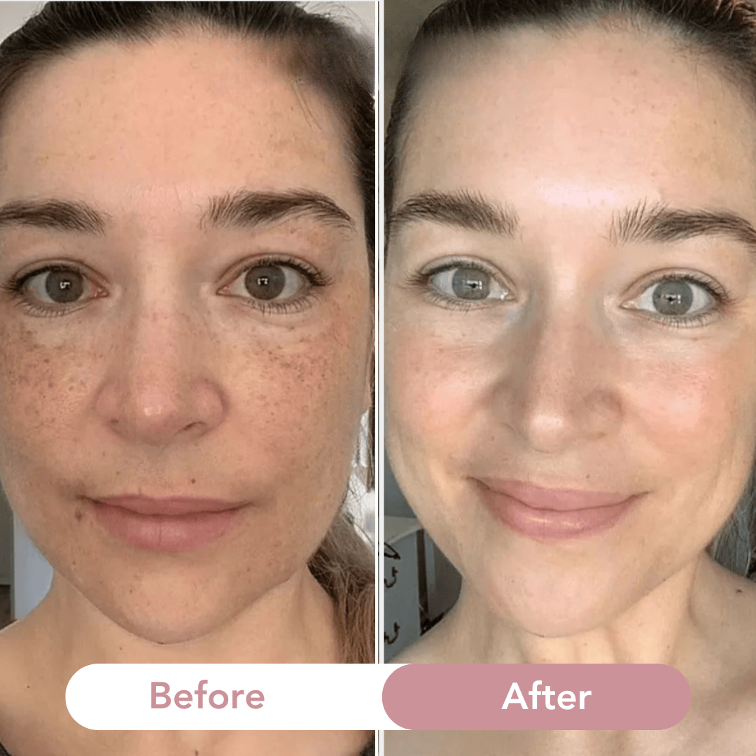Bio-Collageen Anti-Rimpel Masker